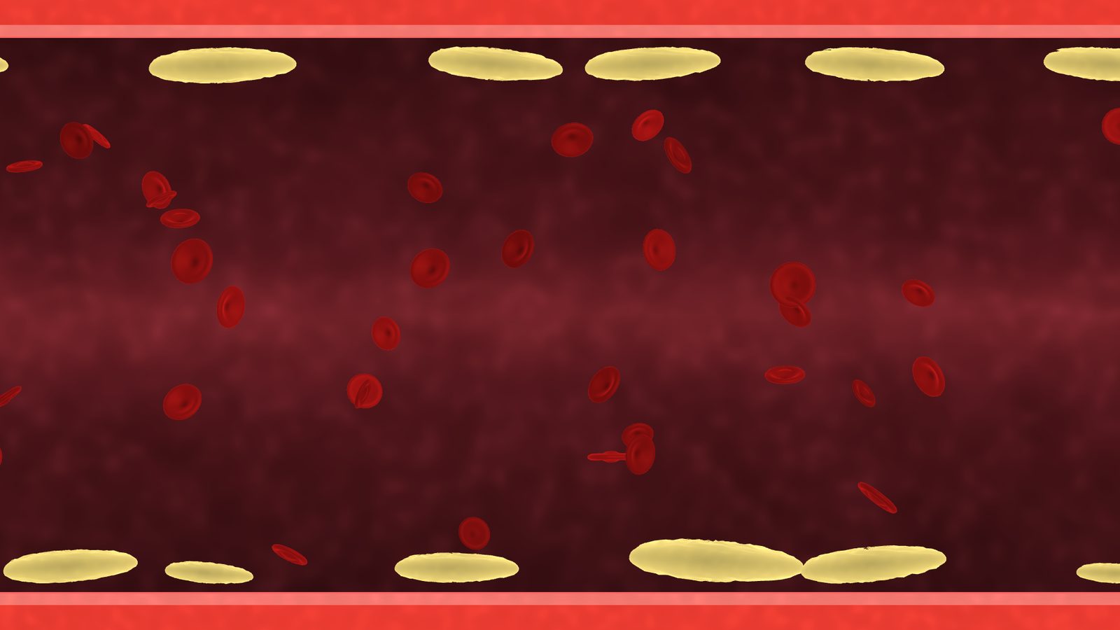 Blood Vessel — LDL Cleanup