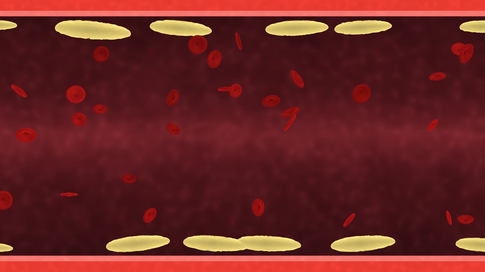Blood Vessel — LDL Cleanup